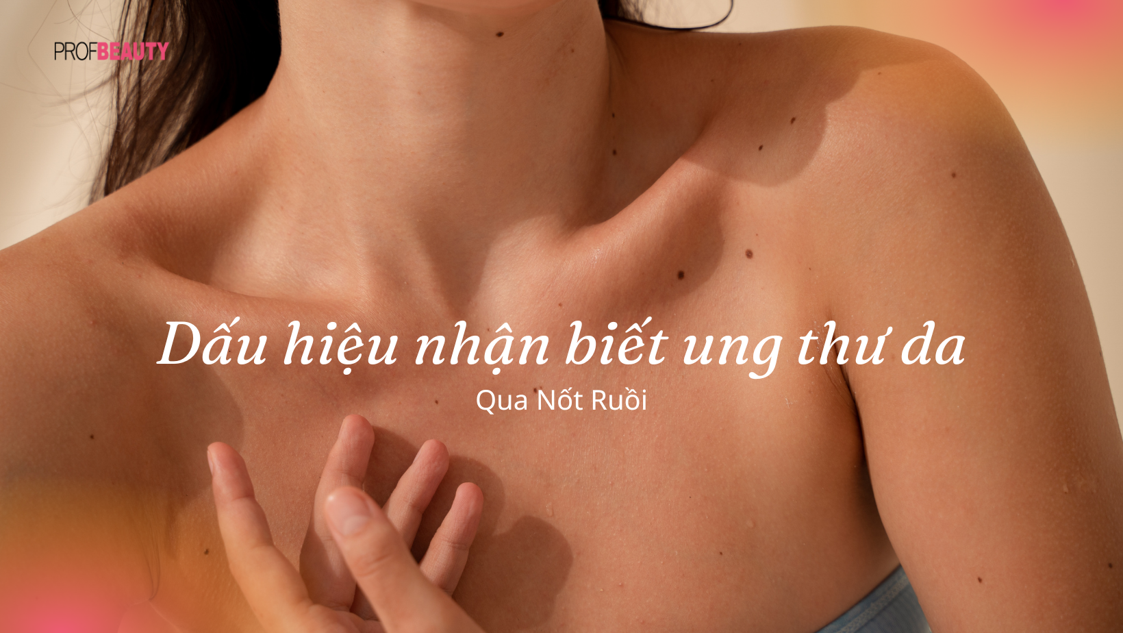 Cảnh giác với nốt ruồi: Dấu hiệu vàng nhận biết ung thư da sớm