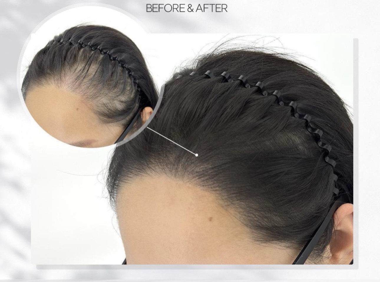 master-chakra-ling-se-trinh-dien-ky-thuat-vi-cham-sac-to-da-dau-tai-royal-pmu-1