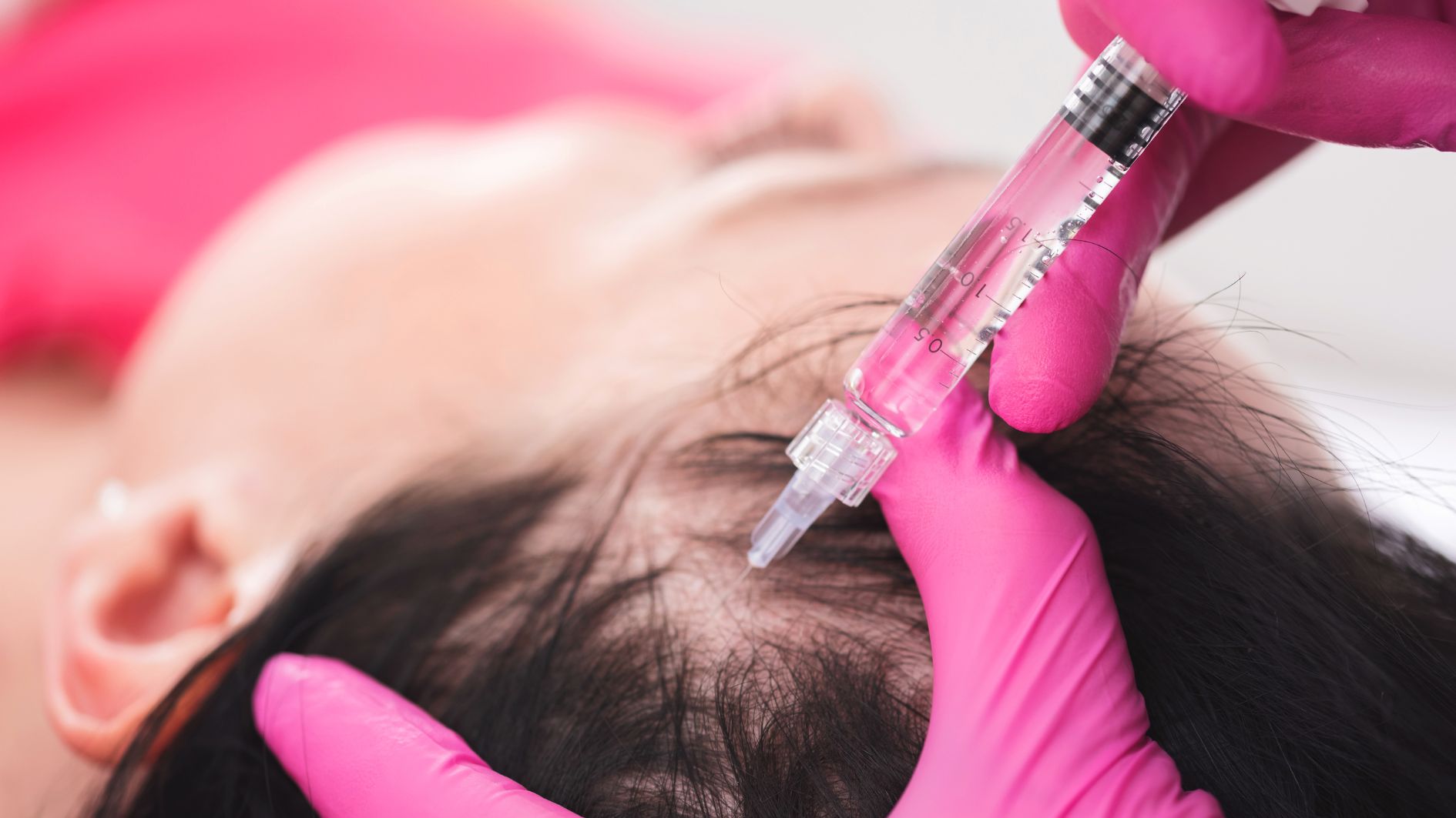 10-phuong-phap-lam-dep-tot-nhat-duoc-bac-si-simon-ourian-binh-chon-10