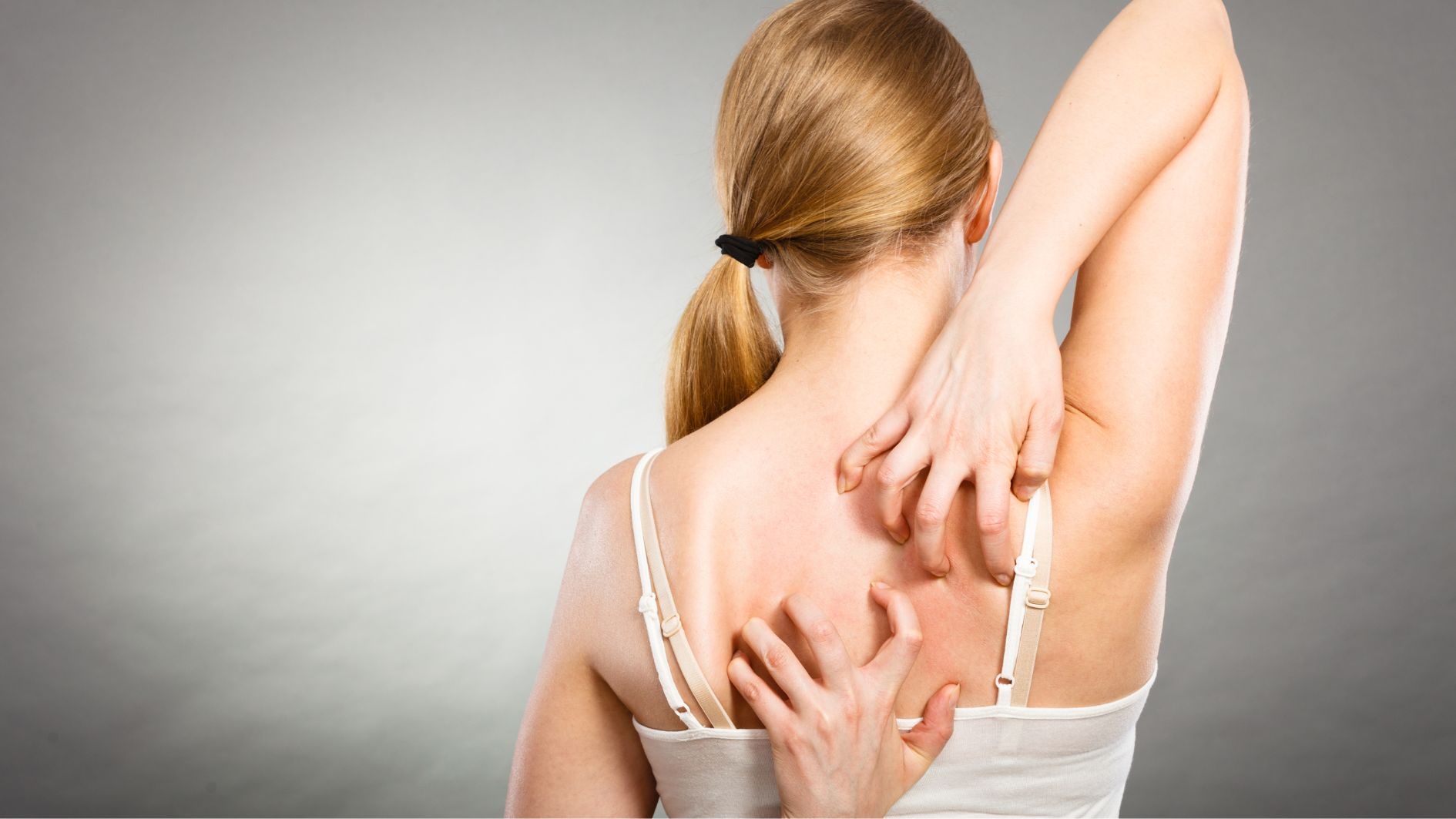 5-cach-tri-mun-lung-tai-nha-hieu-qua-ma-ai-cung-nen-thu-1