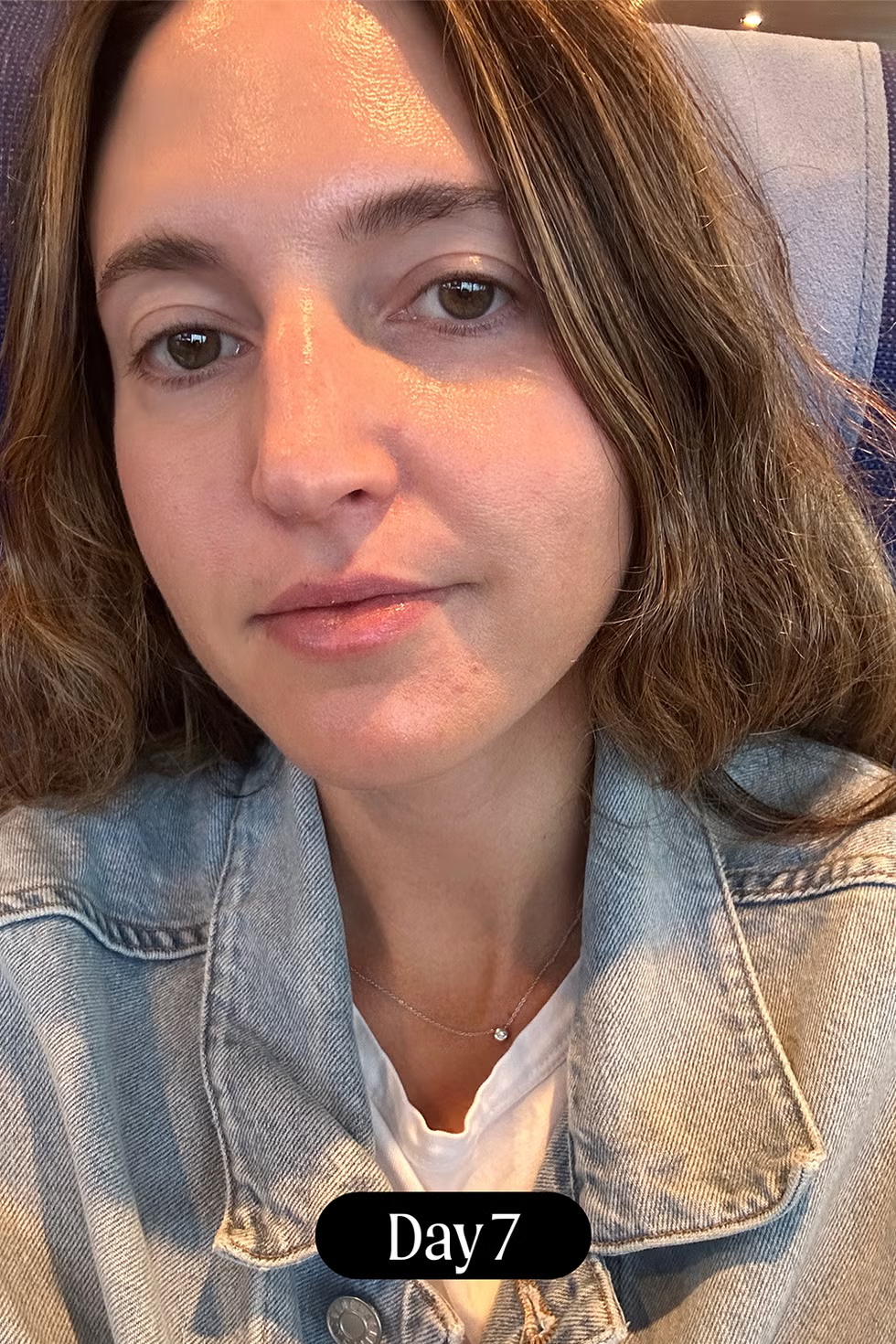 bi-quyet-giup-da-cang-bong-bang-phuong-phap-tri-lieu-laser-halo-1