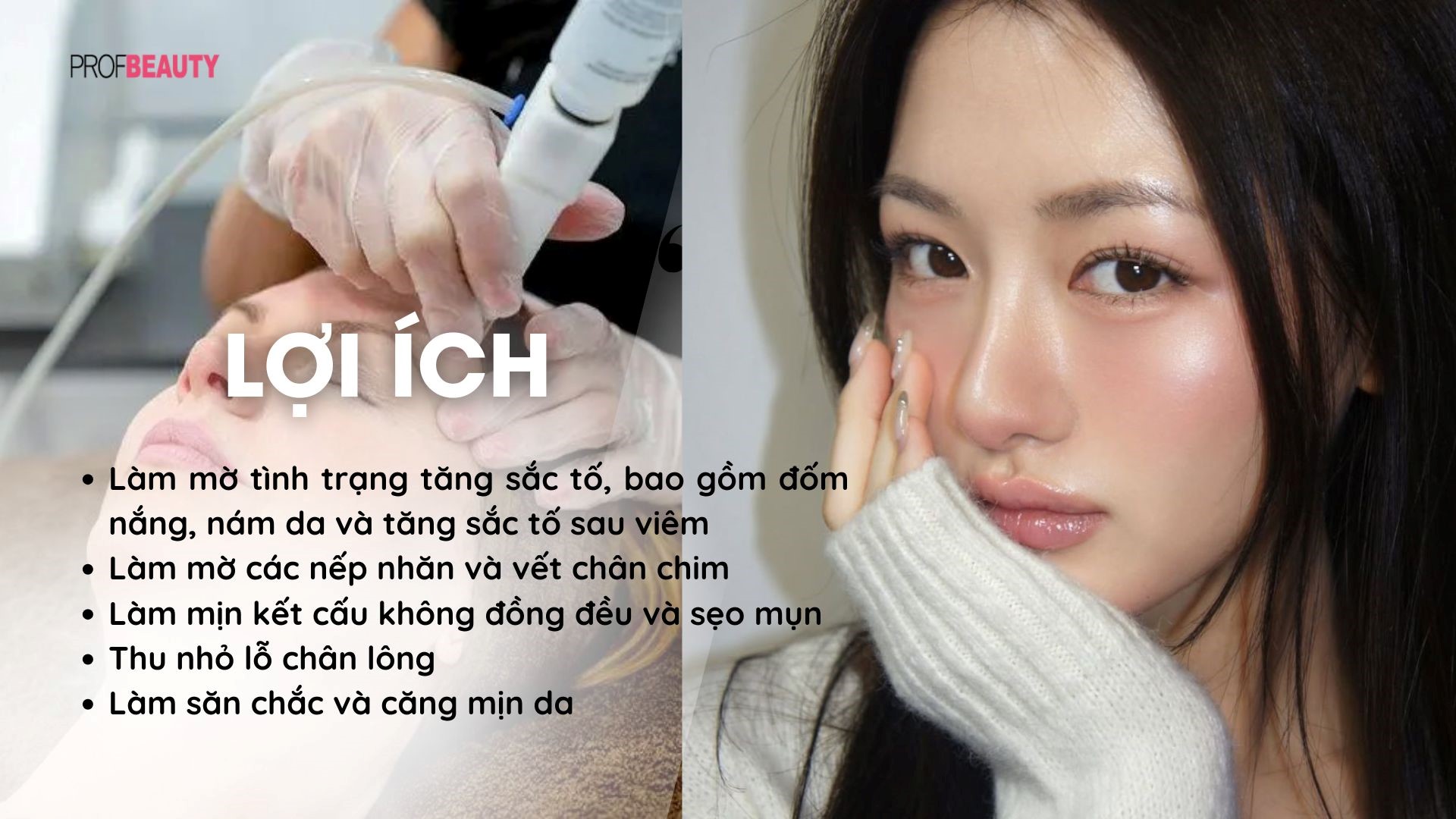 bi-quyet-giup-da-cang-bong-bang-phuong-phap-tri-lieu-laser-halo-2