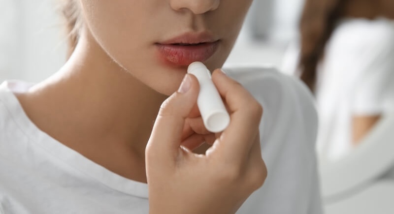 Nổi mẩn, ngứa hoặc herpes là các vấn đề thường gặp sau khi làm môi. 