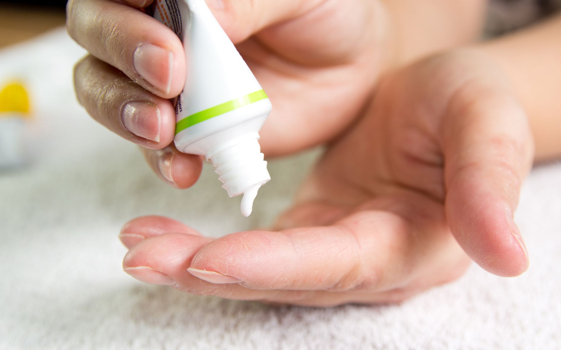 10-meo-giup-loai-bo-2