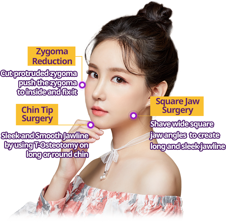 3 thủ thuật phẫu thuật đường viền khuôn mặt phổ biến 